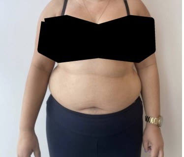 Antes